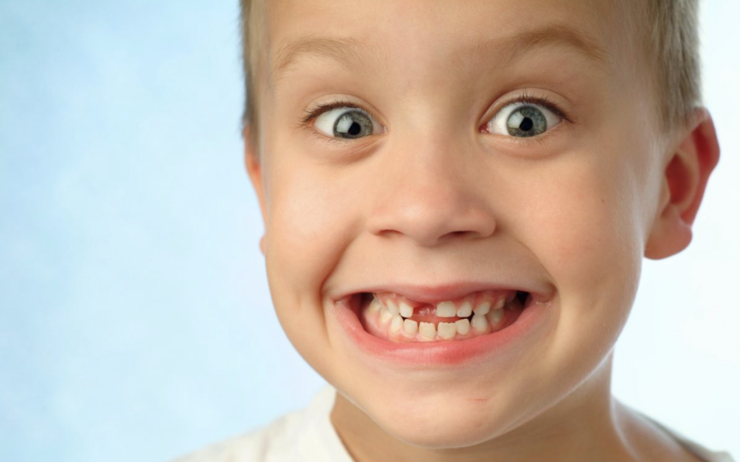 kids tooth extraction edmonton