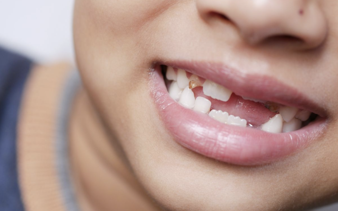pediatric dentist edmonton