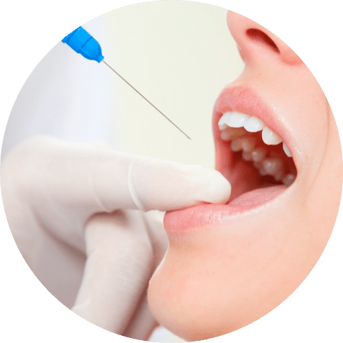Dentist administering local anesthesia injection to patient’s gums before dental procedure