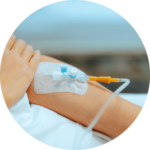 Patient arm with IV drip catheter inserted for medical treatment in hospital setting