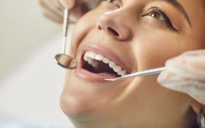 How Often Should I Get My Teeth Cleaned in Edmonton?